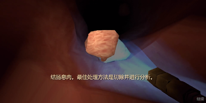 大肠的复仇手机版 大肠的复仇手机版