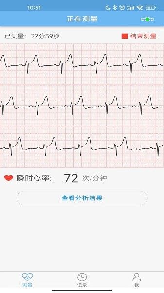 数维康心电(SwayCore)